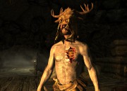 The Elder Scrolls V: Skyrim
