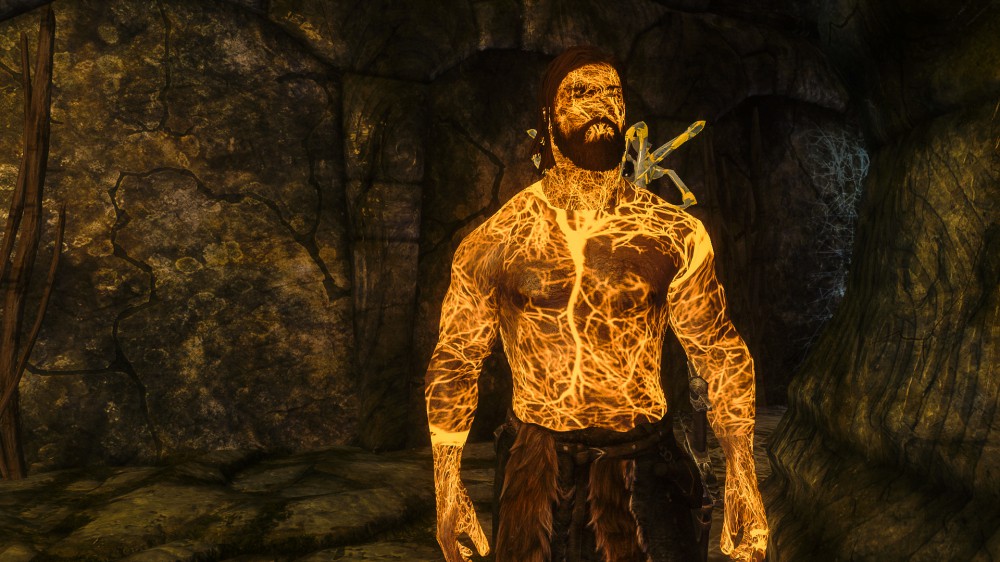 The Elder Scrolls V: Skyrim